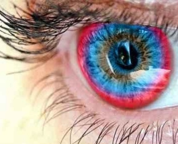 Изменить цвет глаз помогут хирурги