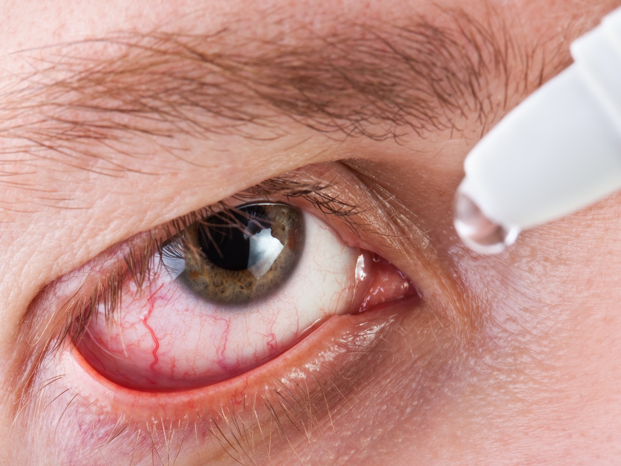 Синдром сухого глаза опаснее представляет серьёзную опасность для общества: исследование США