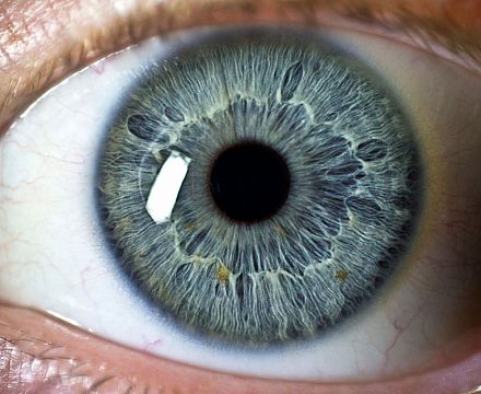 Ученые Великобритании: болезнь Альцгеймера начинается с изменений в сетчатке глаз