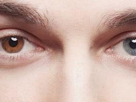 Гетерохромия – что это, и должна ли она быть поводом для беспокойства? - гетерохромия, разные глаза, цвет глаз,