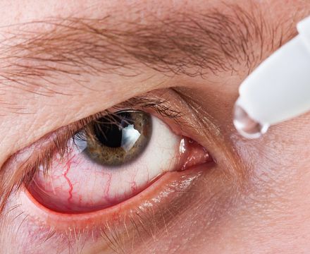 Синдром сухого глаза опаснее представляет серьёзную опасность для общества: исследование США