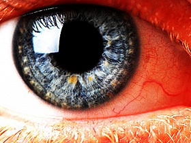 Как сделать красные глаза в домашних условиях - красный, дома, красные глаза, совет, полезное
