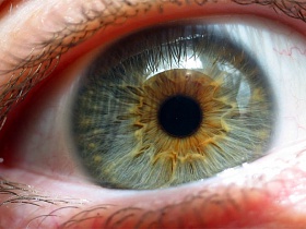 Меланоз глаз (меланопатия) - Меланоз, меланопатия, сетчатка