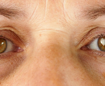Как избежать возрастного снижения остроты зрения