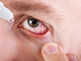 Растет число людей, страдающих синдромом сухого глаза - синдром сухого глаза