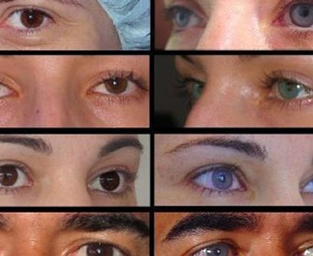 Какой цвет глаз самый редкий?