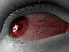 Красные белки глаз – что делать? - покраснение, красные, резь, что делать, устают