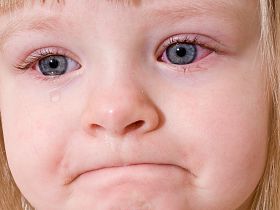 Покраснение глаз у ребенка: методы лечения - лечение глаз, конъюктивит